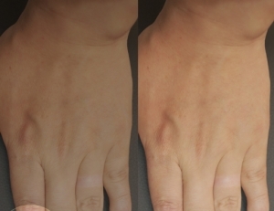 탑 기사 이미지